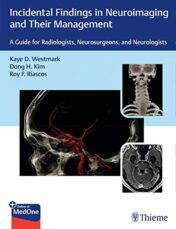Incidental Findings in Neuroimaging and Their Management: A Guide for Radiologists, Neurosurgeons, and Neurologists (Original PDF)