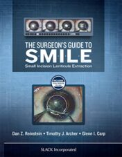 The Surgeon’s Guide to SMILE: Small Incision Lenticule Extraction (PDF)