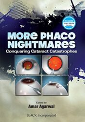 More Phaco Nightmares: Conquering Cataract Catastrophes (PDF)