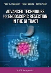 Advanced Techniques for Endoscopic Resection in the GI Tract (EPUB+PDF)
