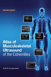Atlas of Musculoskeletal Ultrasound of the Extremities (Original PDF)