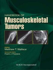 Handbook of Musculoskeletal Tumors (Original PDF)