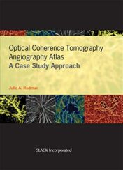 Optical Coherence Tomography Angiography Atlas: A Case Study Approach (PDF)