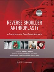 Reverse Shoulder Arthroplasty: A Comprehensive Case-Based Approach 1921 Original PDF