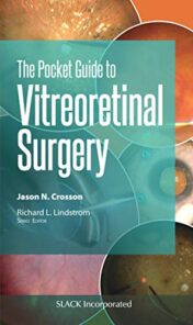 The Pocket Guide to Vitreoretinal Surgery (Pocket Guides) (Original PDF)