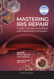 Mastering Iris Repair: A Video Textbook of Iris Repair and Pupilloplasty Techniques (Original PDF)