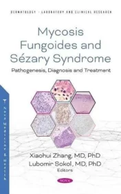 Mycosis Fungoides : Causes, Diagnosis and Treatment 2021 Original pdf