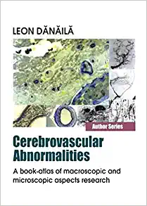 Cerebrovascular Abnormalities: A Book-Atlas of Macroscopic and Microscopic Aspects Research (Original PDF from Publisher)