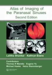 Atlas of Imaging of the Paranasal Sinuses, Second Edition 2006 Original PDF