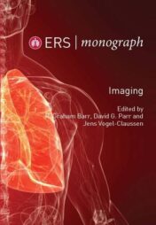 Imaging (ERS Monograph 70)
