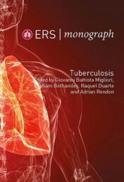 ERS Monograph 82 (TUberculosis) (PDF)