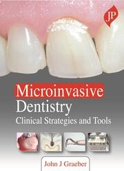 Microinvasive Dentistry Clinical Strategies and Tools By John J Graeber
