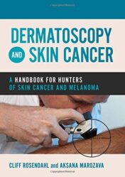 Dermatoscopy and Skin Cancer: A handbook for hunters of skin cancer and melanoma (Original PDF)
