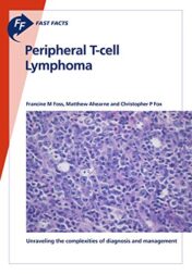 Fast Facts: Peripheral T-cell Lymphoma: Unraveling the complexities of diagnosis and management (Original PDF)