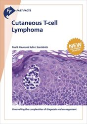 Fast Facts: Cutaneous T-cell Lymphoma (Original PDF)