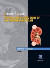 Specialty Imaging: Pitfalls and Classic Signs of the Abdomen and Pelvis (ORIGINAL PDF)