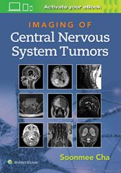 Imaging of Central Nervous System Tumors  ePub3+Converted PDF 