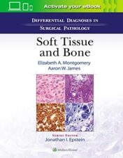 Differential Diagnoses in Surgical Pathology: Soft Tissue and Bone  