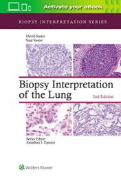 Biopsy Interpretation of the Lung, 2ed (Biopsy Interpretation Series)  