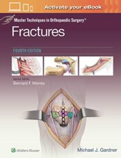 Master Techniques in Orthopaedic Surgery: Fractures, 4ed (ePub+Converted PDF)