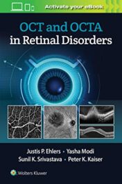 OCT and OCT Angiography in Retinal Disorders (ePub+PDF)