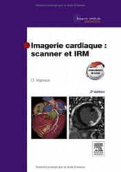 Imagerie cardiaque: scanner et IRM, 2e (PDF)