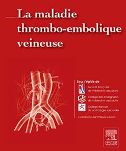 La maladie thrombo-embolique veineuse (Hors collection) (French Edition) (Original PDF from Publisher)