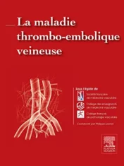 La maladie thrombo-embolique veineuse (Hors collection) (French Edition) 2015 Original PDF
