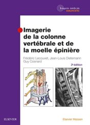 Imagerie De La Colonne Vertébrale Et De La Moelle Épinière (French Edition), 3rd Edition (PDF)