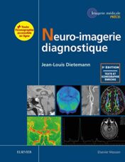 Neuro-imagerie diagnostique, 3e 2018 Original PDF