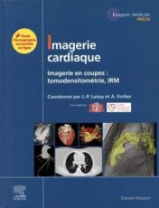 Imagerie cardiaque: Imagerie en coupes : scanner, IRM (Imagerie médicale : Précis) (French Edition) (True PDF Publisher Quality)