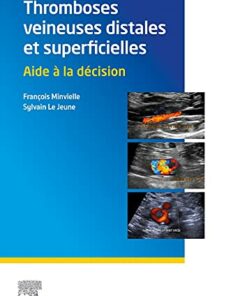 Thromboses veineuses distales et superficielles: Aide à la décision (French Edition) (Original PDF from Publisher)