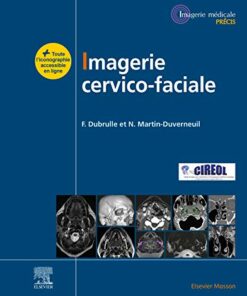 Imagerie cervicofaciale: Massif facial – Sinus – Voies aérodigestives supérieures – Pathologies cervicales – Espaces profonds (Imagerie médicale : Précis) (French Edition) (EPUB)