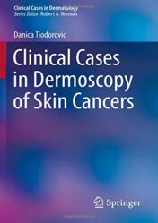 Clinical Cases in Dermoscopy of Skin Cancers (Clinical Cases in Dermatology) (Original PDF)