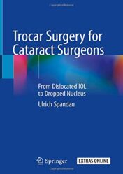 Trocar Surgery for Cataract Surgeons: From Dislocated IOL to Dropped Nucleus (Original PDF)
