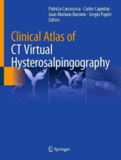 Clinical Atlas of CT Virtual Hysterosalpingography (Original PDF)