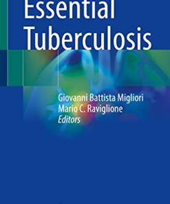 Essential Tuberculosis (Original PDF from Publisher)
