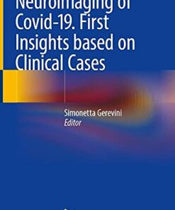 Neuroimaging of Covid-19. First Insights based on Clinical Cases (Original PDF from Publisher)