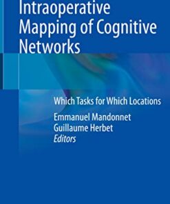 Intraoperative Mapping of Cognitive Networks: Which Tasks for Which Locations (Original PDF from Publisher)