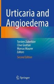 Urticaria and Angioedema 2010 Original pdf