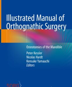 Illustrated Manual of Orthognathic Surgery (Original PDF from Publisher)