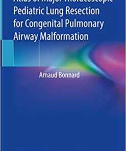 Atlas of Major Thoracoscopic Pediatric Lung Resection for Congenital Pulmonary Airway Malformation (Original PDF from Publisher)