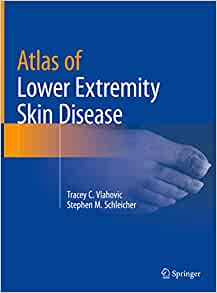 Atlas of Lower Extremity Skin Disease (Original PDF from Publisher)