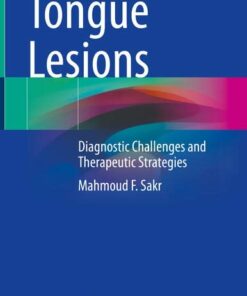 Tongue Lesions: Diagnostic Challenges and Therapeutic Strategies (Original PDF from Publisher)