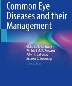 Common Eye Diseases and their Management, 5th Edition (EPUB)