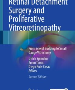 Retinal Detachment Surgery and Proliferative Vitreoretinopathy, 2nd Edition (Original PDF from Publisher)