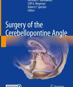 Surgery of the Cerebellopontine Angle, 2nd Edition (EPUB)