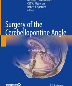 Surgery of the Cerebellopontine Angle, 2nd Edition (Original PDF from Publisher)