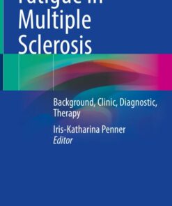Fatigue in Multiple Sclerosis (Original PDF from Publisher)