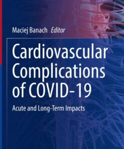 Cardiovascular Complications of COVID-19 (Original PDF from Publisher)